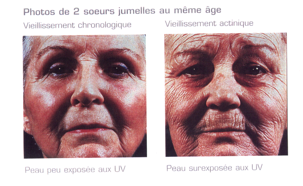 VETEMENT ANTI UV : PREVENTION SOLAIRE – PROTECTION SOLAIRE : Protection des  enfants et des adultes: Vêtements antiUV spécifiques Les trois E E E  Asfoder 2022 Hervé Van landuyt – ASFODER